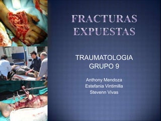 TRAUMATOLOGIA
GRUPO 9
Anthony Mendoza
Estefania Vintimilla
Stevenn Vivas
 