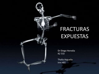 FRACTURAS
EXPUESTAS
Dr Diego Heredia
R2 T/O
Thalia Arguello
Irm HEE
 