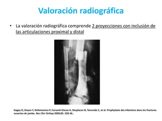 Valoración radiográfica
• La valoración radiográfica comprende 2 proyecciones con inclusión de
las articulaciones proximal y distal
Gagey O, Doyon F, Dellamonica P, Carsenti-Etesse H, Desplaces N, Tancrede C, et al. Prophylaxie des infections dans les fractures
ouvertes de jambe. Rev Chir Orthop 2009;85: 328-36..
 