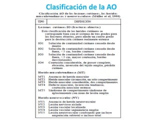 Clasificación de la AO
 