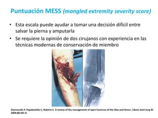 Puntuación MESS (mangled extremity severity score)
• Esta escala puede ayudar a tomar una decisión difícil entre
salvar la pierna y amputarla
• Se requiere la opinión de dos cirujanos con experiencia en las
técnicas modernas de conservación de miembro
Giannoudis P, Papakostidis C, Roberts C. A review of the management of open fractures of the tibia and femur. J Bone Joint Surg Br
2009;88:281-9.
 