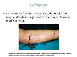 Definición
• Se denomina fractura expuesta a toda solución de
continuidad de un segmento óseo en contacto con el
medio exterior.
Coutavoz M. Observation sur la guérison d’une fracture de la jambe droite, avec déperdition considérable du tibia. In:
DelahaysA. editor. Paris: Mémoires de l’Académie Royale de chirurgie; 1855. p. 45-8.
 