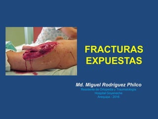 FRACTURAS
EXPUESTAS
Md. Miguel Rodríguez Philco
Residente de Ortopedia y Traumatología
Hospital Goyeneche
Arequipa - 2016
 