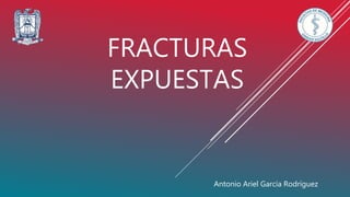 FRACTURAS
EXPUESTAS
Antonio Ariel García Rodríguez
 