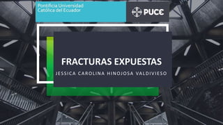 FRACTURAS EXPUESTAS
JESSICA CAROLINA HINOJOSA VALDIVIESO
 
