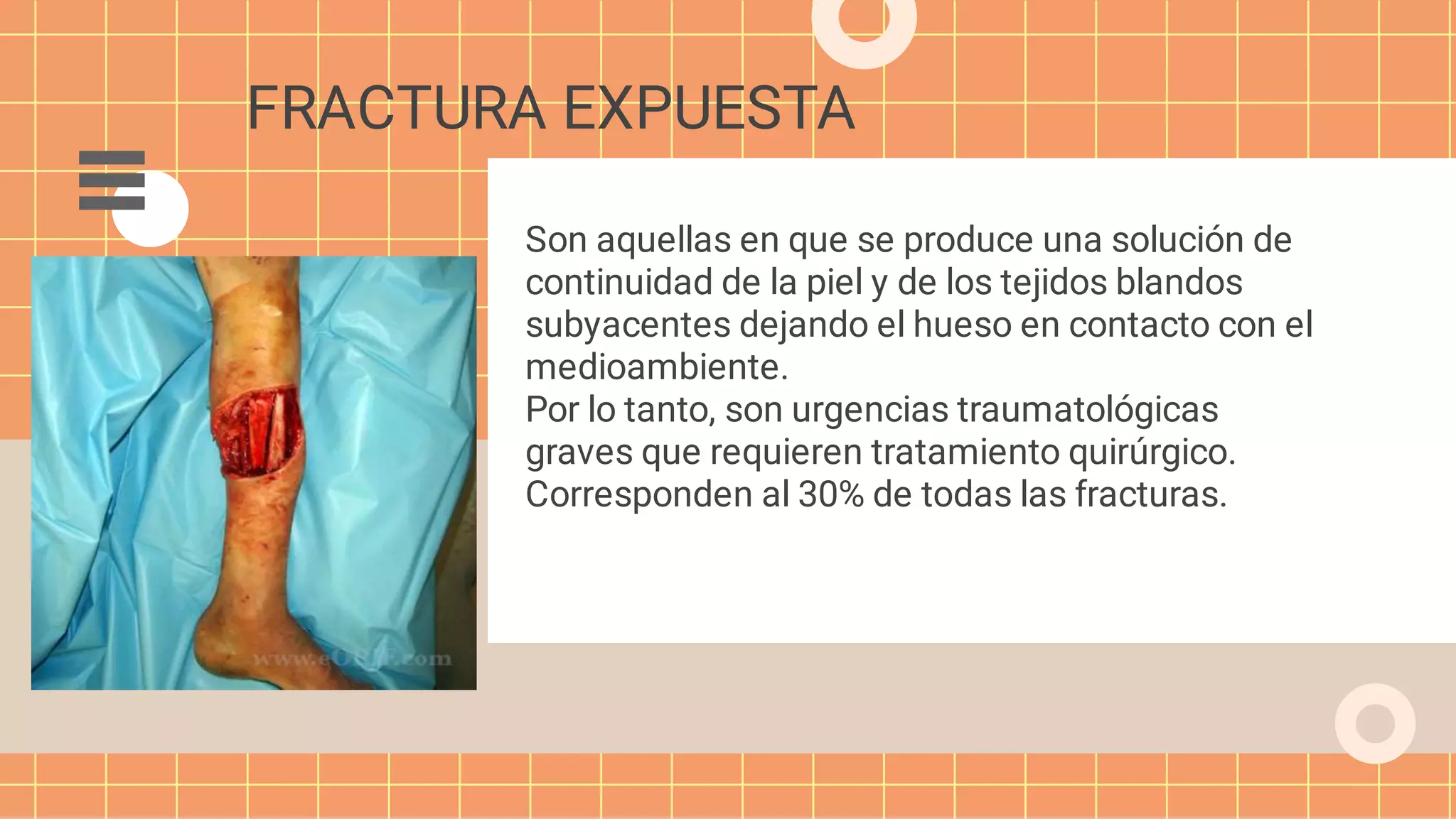 Fracturas Expuestas 2022 pdf fracturas-expuestas-2022-pdf