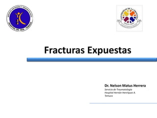Fracturas Expuestas Dr. Nelson Matus Herrera Servicio de Traumatología Hospital Hernán Henríquez A. Temuco 