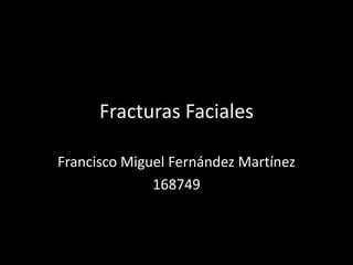 Fracturas Faciales

Francisco Miguel Fernández Martínez
              168749
 