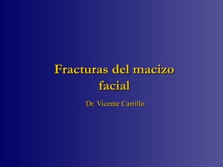 Fracturas del macizoFracturas del macizo
facialfacial
Dr. Vicente CarrilloDr. Vicente Carrillo
 
