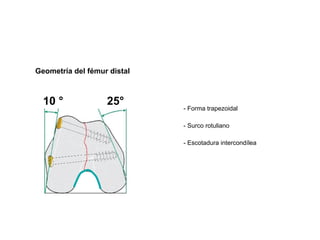 Geometría del fémur distal



  10 °             25°
                             - Forma trapezoidal

                             - Surco rotuliano

                             - Escotadura intercondílea
 