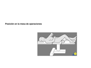 Posición en la mesa de operaciones
 