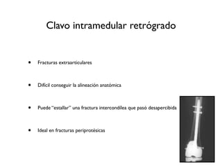 Clavo intramedular retrógrado


•   Fracturas extraarticulares



•   Difícil conseguir la alineación anatómica



•   Puede “estallar” una fractura intercondílea que pasó desapercibida



•   Ideal en fracturas periprotésicas
 