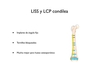 LISS y LCP condílea



•   Implante de ángulo ﬁjo



•   Tornillos bloqueados



•   Mucho mejor para hueso osteoporótico
 