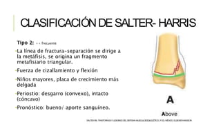CLASIFICACIÓNDESALTER- HARRIS
Tipo 2: ++ frecuente
•La línea de fractura-separación se dirige a
la metáfisis, se origina un fragmento
metafisiario triangular.
•Fuerza de cizallamiento y flexión
•Niños mayores, placa de crecimiento más
delgada
•Periostio: desgarro (convexo), intacto
(cóncavo)
•Pronóstico: bueno/ aporte sanguíneo.
SALTERRB.TRASTORNOSYLESIONESDELSISTEMAMUSCULOESQUELÉTICO.3ªED.MÉXICO:ELSEVIER-MASSON.
 