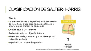 CLASIFICACIÓNDESALTER- HARRIS
Tipo 4:
•Se extiende desde la superficie articular a través
de la epífisis, cruza toda la placa epifisiaria y
atraviesa una porción de la metáfisis.
•Cóndilo lateral del humero
•Reducción abierta y fijación interna
•Pronóstico malo, a menos que se obtenga una
reducción perfecta
•Impide el crecimiento longitudinal
intraarticular
SALTERRB.TRASTORNOSYLESIONESDELSISTEMAMUSCULOESQUELÉTICO.3ªED.MÉXICO:ELSEVIER-MASSON.
 
