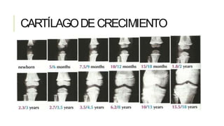 CARTÍLAGODECRECIMIENTO
 