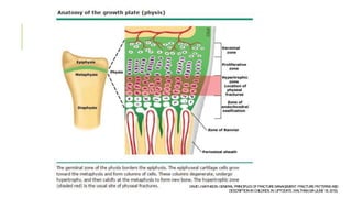 DAVIDJMATHISON.GENERALPRINCIPLESOFFRACTUREMANAGEMENT: FRACTUREPATTERNSAND
DESCRIPTIONINCHILDREN.IN:UPTODATE,WALTHAM,MA(JUNE18,2015).
 