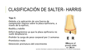 CLASIFICACIÓN DE SALTER- HARRIS
Tipo 5:
•Debida a la aplicación de una fuerza de
compresión intensa sobre la placa epifisiaria, a
través de la epífisis.
•Rodilla y tobillo
•Difícil diagnóstico ya que la placa epifisiaria no
suele desplazarse.
•Prohibir la carga de peso corporal por 3 semanas
•Pronóstico malo
•Detención prematura del crecimiento
SALTER RB. TRASTORNOS Y LESIONES DEL SISTEMA MUSCULOESQUELÉTICO. 3ª ED. MÉXICO: ELSEVIER-MASSON.
 