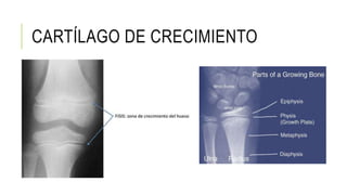 CARTÍLAGO DE CRECIMIENTO
 