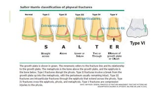Extraarticulares
Intraarticulares
No visible en RX.
DAVID J MATHISON. GENERAL PRINCIPLES OF FRACTURE MANAGEMENT: FRACTURE PATTERNS AND
DESCRIPTION IN CHILDREN. IN: UPTODATE, WALTHAM, MA (JUNE 18, 2015).
 