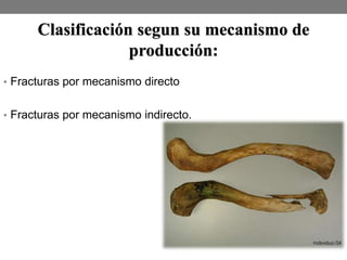 Clasificación segun su mecanismo de
producción:
• Fracturas por mecanismo directo
• Fracturas por mecanismo indirecto.
 