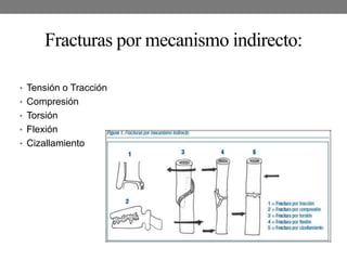 Fracturas por mecanismo indirecto:
• Tensión o Tracción
• Compresión
• Torsión
• Flexión
• Cizallamiento
 