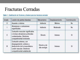Fracturas Cerradas
 