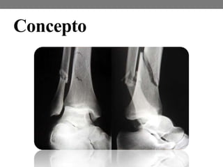 Concepto
 