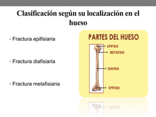 Clasificación según su localización en el
hueso
• Fractura epifisiaria
• Fractura diafisiaria
• Fractura metafisiaria
 