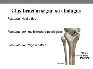 Clasificación segun su etiología:
• Fracturas Habituales
• Fracturas por insuficiencia o patológicas
• Fracturas por fatiga o estrés
 