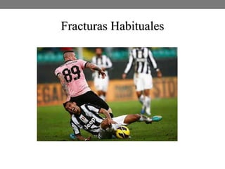 Fracturas Habituales
 