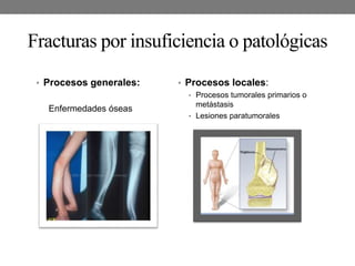 Fracturas por insuficiencia o patológicas
• Procesos generales:
Enfermedades óseas
• Procesos locales:
• Procesos tumorales primarios o
metástasis
• Lesiones paratumorales
 