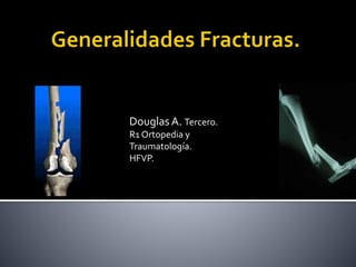 Douglas A. Tercero.
R1 Ortopedia y
Traumatología.
HFVP.
 