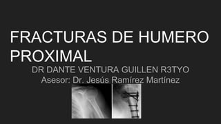 FRACTURAS DE HUMERO
PROXIMAL
DR DANTE VENTURA GUILLEN R3TYO
Asesor: Dr. Jesús Ramírez Martínez
 