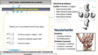 FRACTURAS, LUXACIONES DE LA MANO
ANATOMÍA DEL SEMILUNAR
Medigraphic volume 3 número 4 octubre.Dic 2007, “Anatomía del
escafoides”,
“Media luna”, concavidad mirando hacia abajo
Contorno regular Angulo + 130°
Contorno cuadrado ángulo 100°
Contorno doble
 
