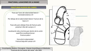FRACTURAS, LUXACIONES DE LA MANO
FRACTURAS HUESOS DEL CARPO
CLASIFICACIÓN DE SCHERNBERG:
Localización y dirección del trazo de fractura:
5 tipos de fractura
Puntos de referencia:
Fuera tuberosidad lateral
Dentro: Línea de máxima densidad
Trazo por fuera de tuberosidad lateral =
transtuberositaria o IV
Por debajo de la tuberosidad lateral: Fractura de la
base o V
Trazo alto pero debajo línea de fractura polo
proximal: Alta del cuerpo o II
Localización alta y termina por dentro de la unión
superficie escafosemilunar:
Fractura polar I
Cerca de la tuberosidad :
Fractura baja del cuerpo o III
Encyclopedie Medico- Chirurgical , Elsevier Scientifiques et Medicales
“Fracturas de los huesos del carpo” año 2001
 