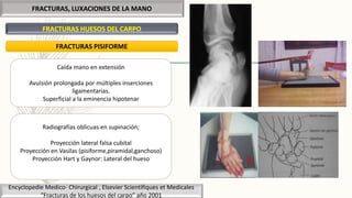 FRACTURAS, LUXACIONES DE LA MANO
FRACTURAS HUESOS DEL CARPO
Encyclopedie Medico- Chirurgical , Elsevier Scientifiques et Medicales
“Fracturas de los huesos del carpo” año 2001
FRACTURAS PISIFORME
Caída mano en extensión
Avulsión prolongada por múltiples inserciones
ligamentarias.
Superficial a la eminencia hipotenar
Radiografías oblicuas en supinación;
Proyección lateral falsa cubital
Proyección en Vasilas (pisiforme,piramidal,ganchoso)
Proyección Hart y Gaynor: Lateral del hueso
 