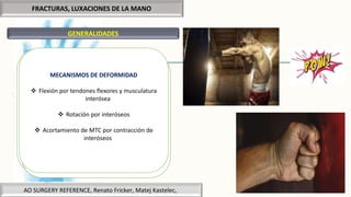 FRACTURAS, LUXACIONES DE LA MANO
GENERALIDADES
++ Más frecuentes de la extremidad superior
10% del total de fracturas
++ Hombres 10 – 40 años
Los rayos mas externos son los más afectados
Complicarse deformidades por falta de
tratamiento
Rigidez por tratamiento excesivo
Deformidades óseas por tratamiento incorrecto
MECANISMOS DE PRODUCCIÓN
Directos:
 Contusión
 Aplastamiento
 Lesiones penetrantes
Indirectos:
 Tracción
 Tensión
 Torsión
 Compresión
MECANISMOS DE DEFORMIDAD
 Flexión por tendones flexores y musculatura
interósea
 Rotación por interóseos
 Acortamiento de MTC por contracción de
interóseos
AO SURGERY REFERENCE, Renato Fricker, Matej Kastelec,
 