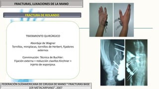 FRACTURAS, LUXACIONES DE LA MANO
FRACTURA DE ROLANDO
FEDERACIÓN SUDAMERICANA DE CIRUGIA DE MANO “ FRACTURAS BASE
1ER METACARPIANO”, 2007
TRATAMIENTO QUIRÚRGICO
Abordaje de Wagner
Tornillos, miniplacas, tornillos de Herbert, fijadores
externos
Conminución: Técnica de Buchler:
Fijación externa + reducción clavillos Kirchner +
injerto de esponjosa.
 
