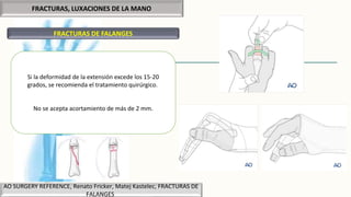 FRACTURAS, LUXACIONES DE LA MANO
FRACTURAS DE FALANGES
AO SURGERY REFERENCE, Renato Fricker, Matej Kastelec, FRACTURAS DE
FALANGES
Si la deformidad de la extensión excede los 15-20
grados, se recomienda el tratamiento quirúrgico.
No se acepta acortamiento de más de 2 mm.
 