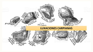 LUXACIONES CARPIANAS
 