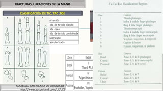 FRACTURAS, LUXACIONES DE LA MANO
SOCIEDAD AMERICANA DE CIRUGIA DE MANO
http://www.eatonhand.com/clf/clf241.htm
CLASIFICACIÓN DE TIC, TAC ,TOE
 