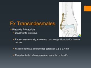 Fx Transindesmales
 Placa de Protección
 Usualmente fx oblicua
 Reducción se consigue con una tracción gentil y rotación interna
del pie
 Fijación definitiva con tornillos corticales 3.5 o 2.7 mm
 Placa tercio de caña actúa como placa de protección
 