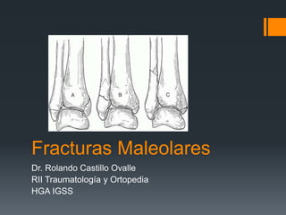 Fracturas Maleolares
Dr. Rolando Castillo Ovalle
RII Traumatología y Ortopedia
HGA IGSS
 