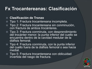 Fx Trocantereanas: Clasificación
 Clasificación de Tronzo
 Tipo 1: Fractura trocantereana incompleta.
 Tipo 2: Fractura trocantereana sin conminución,
con fractura de ambos trocánteres.
 Tipo 3: Fractura conminuta, con desprendimiento
del trocánter menor; la punta inferior del cuello se
encuentra dentro de la cavidad medular de la
diáfisis femoral.
 Tipo 4: Fractura conminuta, con la punta inferior
del cuello fuera de la diáfisis femoral o sea hacia
medial.
 Tipo 5: Fractura trocantereana con oblicuidad
invertida del rasgo de fractura.
 