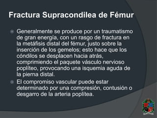 Fractura Supracondilea de Fémur
 Generalmente se produce por un traumatismo
de gran energía, con un rasgo de fractura en
la metáfisis distal del fémur, justo sobre la
inserción de los gemelos; esto hace que los
cóndilos se desplacen hacia atrás,
comprimiendo el paquete vásculo nervioso
poplíteo, provocando una isquemia aguda de
la pierna distal.
 El compromiso vascular puede estar
determinado por una compresión, contusión o
desgarro de la arteria poplítea.
 