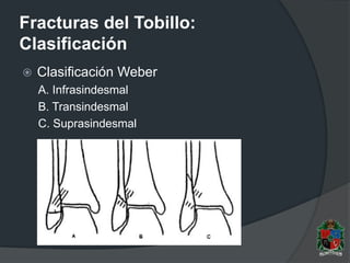 Fracturas del Tobillo:
Clasificación
 Clasificación Weber
A. Infrasindesmal
B. Transindesmal
C. Suprasindesmal
 