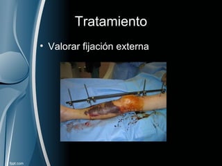 Tratamiento
• Valorar fijación externa
 