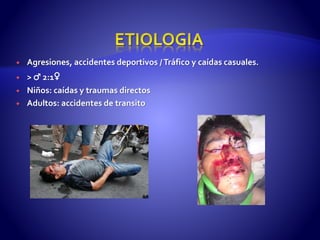  Agresiones, accidentes deportivos /Tráfico y caídas casuales.
 > ♂ 2:1♀
 Niños: caídas y traumas directos
 Adultos: accidentes de transito
 