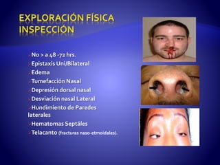 No > a 48 -72 hrs.
Epistaxis Uni/Bilateral
Edema
Tumefacción Nasal
Depresión dorsal nasal
Desviación nasal Lateral
Hundimiento de Paredes
laterales
Hematomas Septáles
Telacanto (fracturas naso-etmoidales).
 